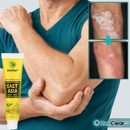 ZenClear™ Crème Herbale