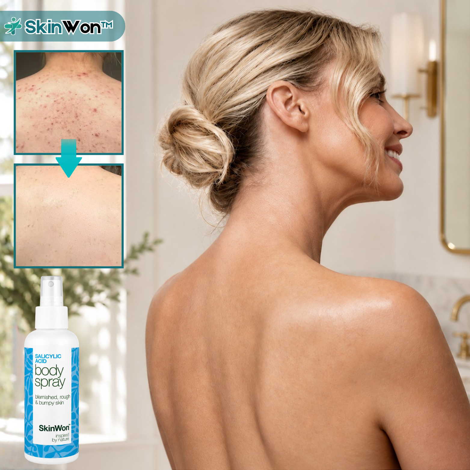 SkinWon™ Spray Corps à l'Acide Salicylique