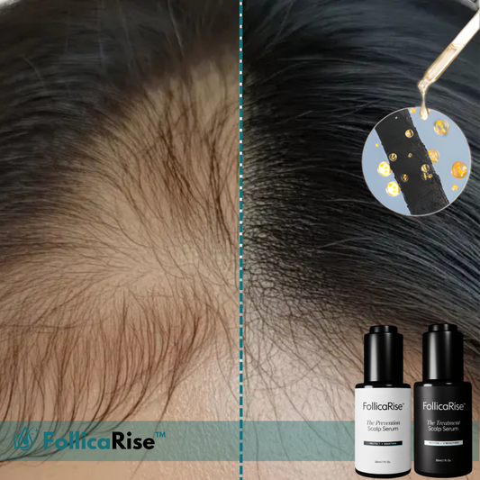 FollicaRise™ Sérum capillaire pour la croissance des cheveux
