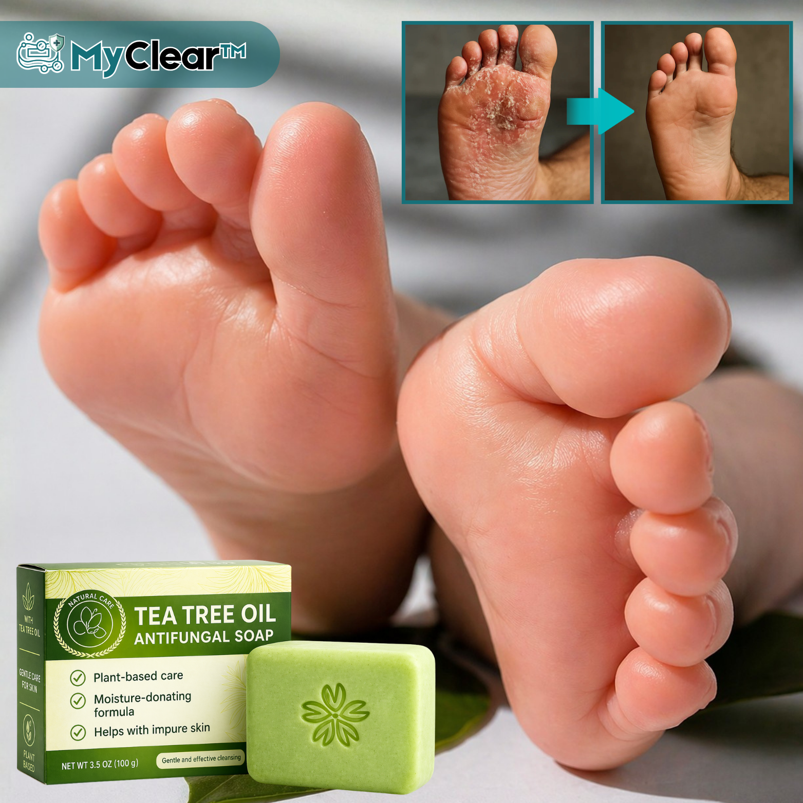 MyClear™ Savon Antifongique