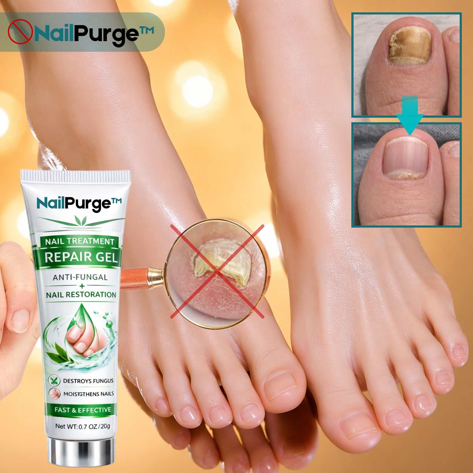 NailPurge™ Gel Réparateur Traitement des Ongles