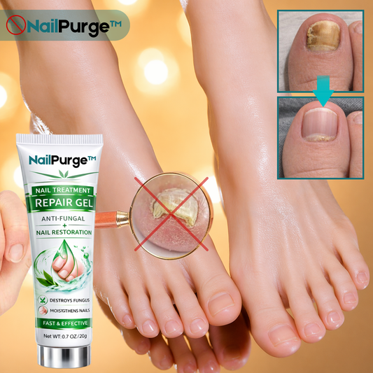 NailPurge™ Gel Réparateur Traitement des Ongles